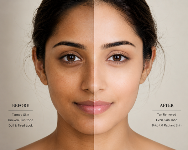 Tan Removal